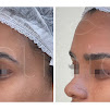 Clinic Bio Estetica | Harmonizao facial e corporal, Fios de sustentao , Preenchimento, Botox, Sculptra, Ultraformer