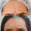 Clnica Pr Esttica em Perdizes, Ultraformer, Lavieen, Rejuvenescimento, Botox Facial, Harmonizao Gltea, Lipo Sem Corte