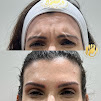 Clnica de Esttica Madame Face Mooca - Harmonizao Facial, Botox, Ultraformer MPT, Lavieen, Intradermoterapia Capilar