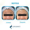 Clnica Biavatti Vila Mariana - Esttica Avanada, Botox, Preenchimento, Esttica e Bioestimulador de Colgeno