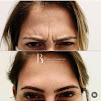 Clnica Esttica My Shape Vila Romana| Limpeza de Pele, Botox, Drenagem, Crioliplise, Gordura Localizada, Depilao a Laser