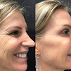 Martelli Care Clinic - Toxina Botulnica em Jardim Paulista - Botox - Bichectomia - Lipoaspirao de Papada
