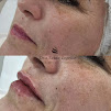 Clnica Medicina Esttica | Ortomolecular | Botox | Dra. Tain Logelso - SP
