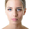 Dr. Jos Henrique - Harmonizao Facial - Botox - Rejuvenescimento - Peeling - Preenchimento - Esttica So Paulo