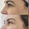 Clnica Esttica Dra. Dbora Malavazzi Ipiranga SP| Botox, Limpeza de Pele, Microagulhamento, Drenagem Linftica, Lipedema