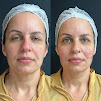 Dra. Juliana Melo - Harmonizao Facial | Botox | Lipo de papada | Rinomodelao