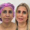 Elleve Esttica Avanada