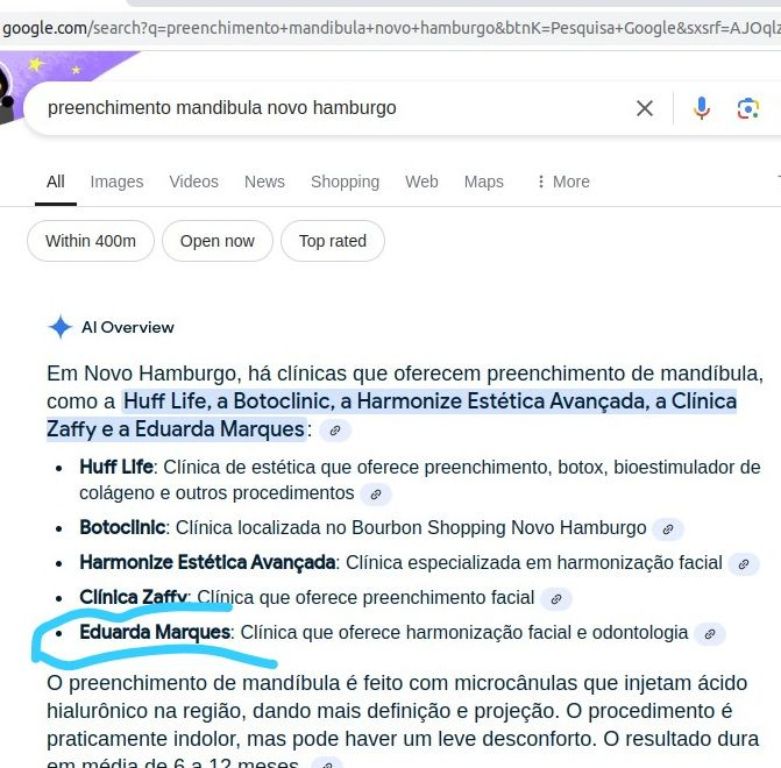 Resultado SEO Harmonização Facial Google